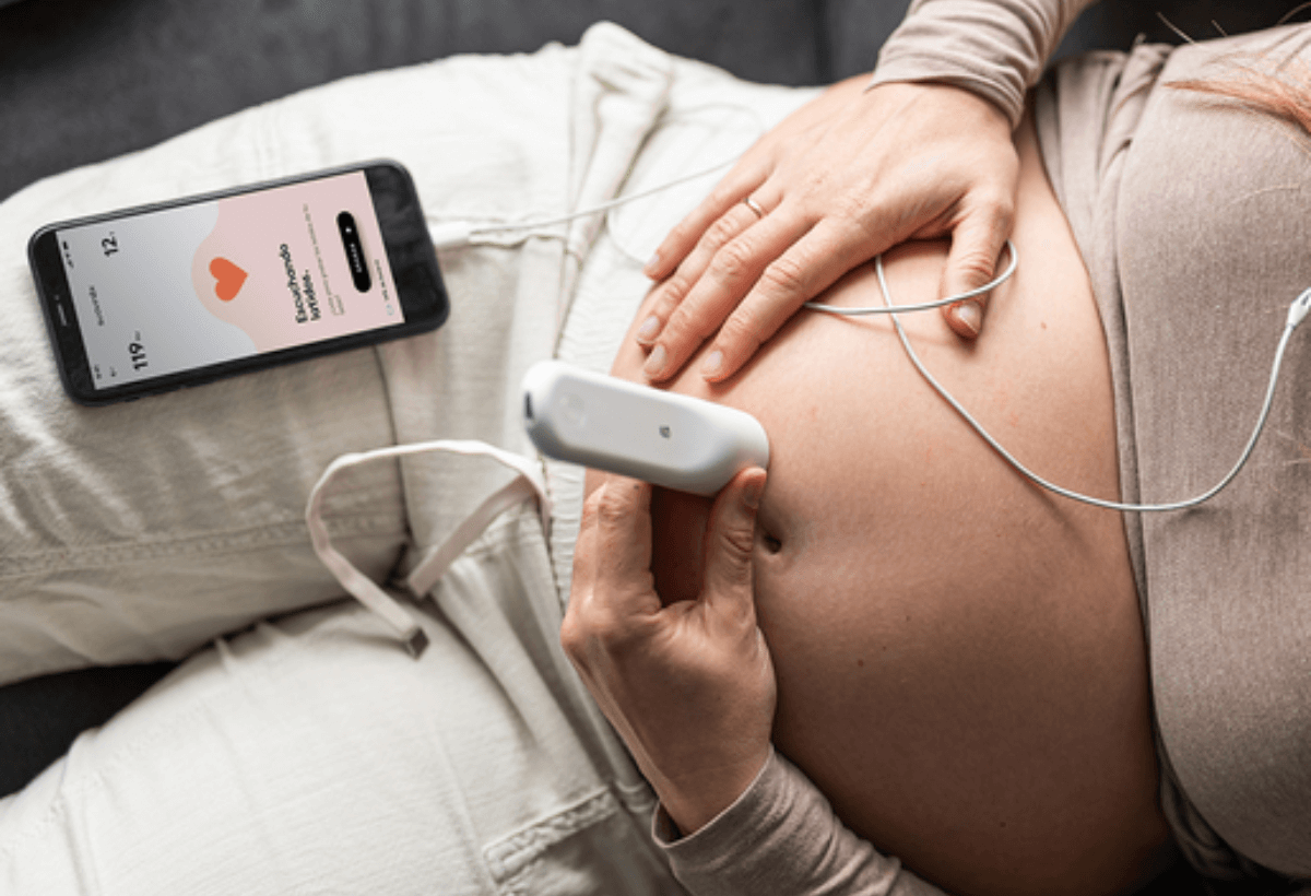 Doppler de Latido Fetal YK 90 B de YONKER, Escucha el latido de tu bebe  desde la semana 16 de embarazo! : .com.mx: Bebé