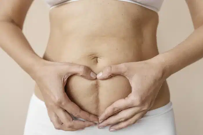 Cómo eliminar la piel sobrante en el abdomen después del embarazo